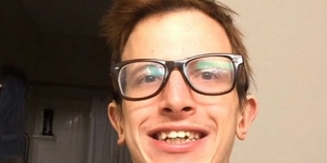 STOP everything you’re doing and watch the story of a young man who is slowly turning to stone!